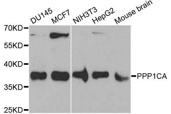 PPP1CA Antikörper  (AA 1-330)