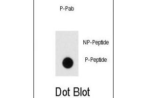 Dot Blot (DB) image for anti-Endophilin (pTyr80) antibody (ABIN3001911) (Endophilin (pTyr80) antibody)