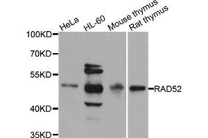 Western blot analysis of extracts of various cell lines, using RAD52 antibody (ABIN5971575) at 1/1000 dilution. (RAD52 antibody)
