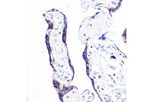 Immunohistochemistry of paraffin-embedded human placenta using PEX2 Rabbit pAb (ABIN7269248) at dilution of 1:100 (40x lens). (PEX2 antibody  (AA 1-130))