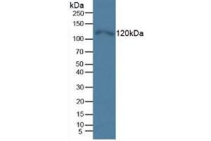 Western blot analysis of Human HeLa cells. (TLR5 antibody  (AA 693-858))