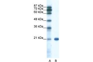 WB Suggested Anti-SSX2 Antibody Titration:  0.