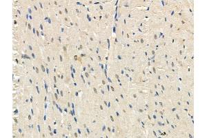 Phospho-TORC2 (Ser275) Antibody at 1/100 staining Rat heart tissue by IHC-P.