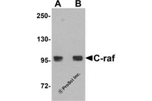 Western Blotting (WB) image for anti-V-Raf-1 Murine Leukemia Viral Oncogene Homolog 1 (RAF1) (N-Term) antibody (ABIN1031286) (RAF1 antibody  (N-Term))