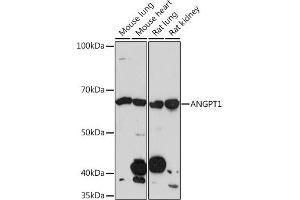 Western blot analysis of extracts of various cell lines, using  Rabbit mAb (ABIN1678801, ABIN3018058, ABIN3018059 and ABIN7101573) at 1:1000 dilution.