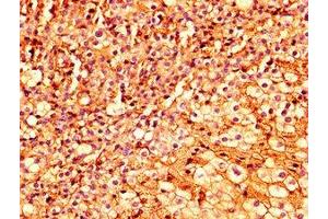 IHC image of ABIN7151937 diluted at 1:300 and staining in paraffin-embedded human adrenal gland tissue performed on a Leica BondTM system. (ESRP2 antibody  (AA 615-720))