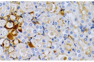Immunohistochemistry of paraffin-embedded Rat kidney using TFF1 Polyclonal Antibody at dilution of 1:200 (40x lens). (TFF1 antibody)