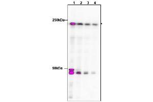 Image no. 1 for anti-TAF1 RNA Polymerase II, TATA Box Binding Protein (TBP)-Associated Factor, 250kDa (TAF1) (C-Term) antibody (ABIN401389)