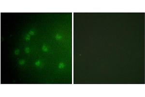 Immunofluorescence analysis of COS7 cells, using Retinoblastoma (Phospho-Thr826) antibody. (Retinoblastoma 1 antibody  (pThr826))