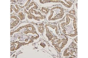 IHC analysis of LPP using anti-LPP antibody (ABIN7599606). (LPP antibody  (AA 10-572))