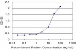 Detection limit for recombinant GST tagged RPS5 is approximately 3ng/ml as a capture antibody. (RPS5 antibody  (AA 106-204))