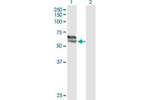Western Blot analysis of STS expression in transfected 293T cell line by STS MaxPab polyclonal antibody. (STS antibody  (AA 1-583))