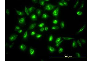 Immunofluorescence of monoclonal antibody to COG7 on HeLa cell. (COG7 antibody  (AA 1-770))