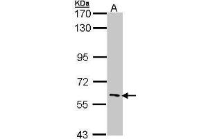 WB Image Sample (30 ug of whole cell lysate) A: Hep G2 , 7. (IRAK3 antibody)