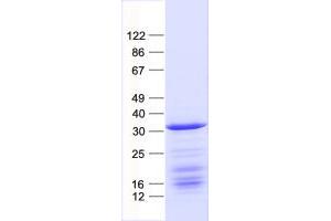 Basic Leucine Zipper Transcription Factor, ATF-Like 2 (BATF2) protein (His tag)