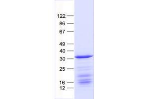 Validation with Western Blot (BATF2 Protein (His tag))