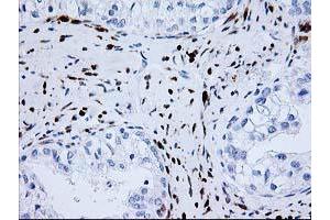 Image no. 1 for anti-NudE Nuclear Distribution E Homolog (A. Nidulans)-Like 1 (NDEL1) antibody (ABIN1499853) (NDEL1 antibody)