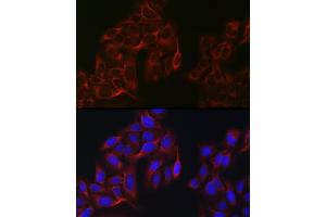 Immunofluorescence analysis of U2OS cells using eIF4 Rabbit pAb (ABIN6129659, ABIN6140076, ABIN6140077 and ABIN6220909) at dilution of 1:100 (40x lens).