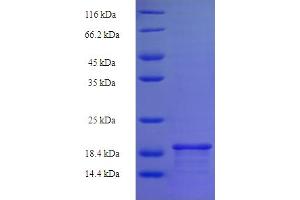 SDS-PAGE (SDS) image for Basic Leucine Zipper Transcriptional Factor ATF-Like 3 (BATF3) (AA 1-133), (full length) protein (His tag) (ABIN4976958) (BATF3 Protein (AA 1-133, full length) (His tag))