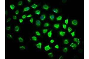 Immunofluorescence staining of A549 cells with ABIN7176582 at 1:116, counter-stained with DAPI. (GLIS2 antibody  (AA 332-505))