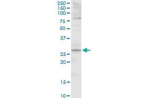 FOSL1 MaxPab polyclonal antibody. (FOSL1 antibody  (AA 1-271))