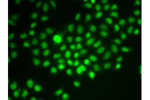 Immunofluorescence analysis of HeLa cells using SMARCE1 antibody. (SMARCE1 antibody  (AA 1-411))