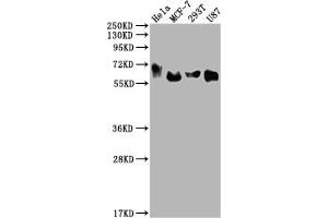 Western Blot Positive WB detected in: Hela whole cell lysate, MCF-7 whole cell lysate, 293T whole cell lysate, U87 whole cell lysate All lanes: GBA antibody at 1:2000 Secondary Goat polyclonal to rabbit IgG at 1/50000 dilution Predicted band size: 60, 58, 55, 51, 30 kDa Observed band size: 60 kDa (Recombinant GBA antibody)