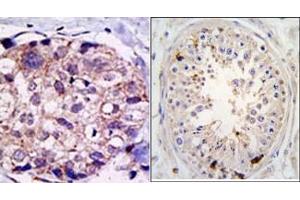 Image no. 1 for anti-Ubiquitin Specific Peptidase 2 (USP2) (C-Term) antibody (ABIN357521) (USP2 antibody  (C-Term))