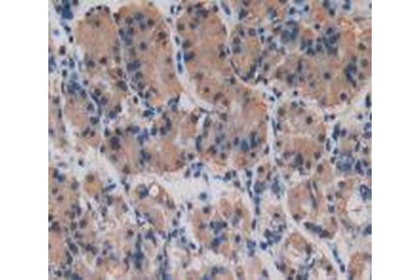 Procollagen Type I Propeptide antibody  (N-Term)