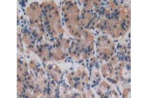 IHC-P analysis of Human Stomach Tissue, with DAB staining. (Procollagen Type I Propeptide antibody  (N-Term))