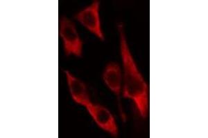 ABIN6274653 staining HeLa cells by IF/ICC. (CYP2U1 antibody  (Internal Region))