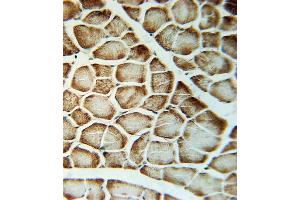 VLDLR Antibody (Center) (ABIN651940 and ABIN2840466) immunohistochemistry analysis in formalin fixed and paraffin embedded human skeletal muscle followed by peroxidase conjugation of the secondary antibody and DAB staining. (VLDLR antibody  (AA 484-510))