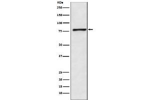 Western blot analysis of Fructose 6 Phosphate Kinase expression in HeLa cell lysate. (Recombinant PFKM antibody)