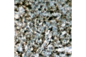 Immunohistochemical analysis of p47 phox (pS304) staining in human lymph node formalin fixed paraffin embedded tissue section. (NCF1 antibody  (C-Term, pSer304))