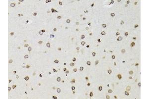 Immunohistochemistry of paraffin-embedded rat brain using TMPO Antibody (ABIN1875122) at dilution of 1:100 (40x lens). (Thymopoietin antibody)