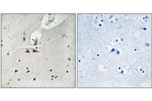 Immunohistochemical analysis of paraffin-embedded human brain tissue using Ephrin B1/B2/B3 (Phospho-Tyr324) antibody (left)or the same antibody preincubated with blocking peptide (right). (EFNB1/EFNB2/EFNB3 (pTyr324) antibody)