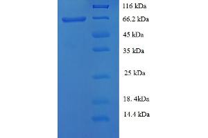 Keratin 38 (KRT38) (AA 2-456) protein (His-SUMO Tag)