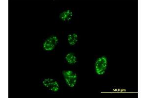 Immunofluorescence of purified MaxPab antibody to SH2D3A on HeLa cell. (SH2D3A antibody  (AA 1-576))
