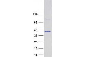 Ankyrin Repeat Domain 16 (ANKRD16) (Transcript Variant 2) protein (Myc-DYKDDDDK Tag)