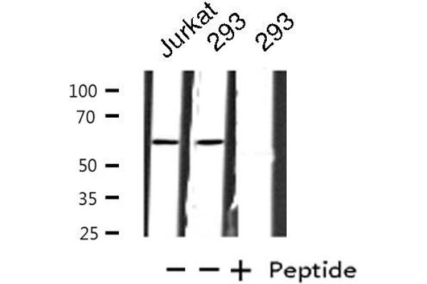 ZNF695 antibody  (C-Term)