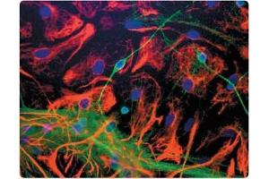Dissociated cell cultures of neonatal Mouse brains, showing NSE-2 (green staining) in neurons.