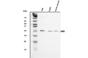 Western blot analysis of SNAP23 using anti-SNAP23 antibody (ABIN7603236). (SNAP23 antibody  (N-Term))