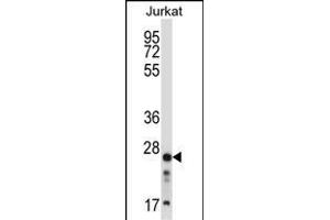 ARHGDIB Antibody (C-term) (ABIN657665 and ABIN2846658) western blot analysis in Jurkat cell line lysates (35 μg/lane). (ARHGDIB antibody  (C-Term))