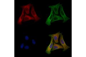 ABIN6256878 and ABIN6274572 staining Hela cells by IF/ICC.