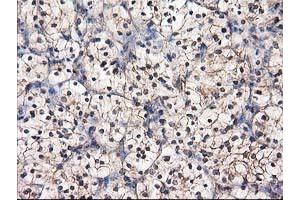 Image no. 1 for anti-Destrin (Actin Depolymerizing Factor) (DSTN) antibody (ABIN1497907) (Destrin antibody)