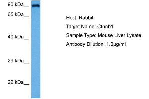 Host:  Rabbit  Target Name:  CTNNB1  Sample Tissue:  Mouse Liver  Antibody Dilution:  1ug/ml (CTNNB1 antibody  (C-Term))