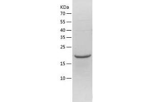C17orf49 Protein (AA 1-172) (His tag)