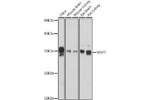 Western blot analysis of extracts of various cell lines, using SRSF7 Rabbit pAb (ABIN7270548) at 1:1000 dilution. (SFRS7 antibody  (AA 60-120))