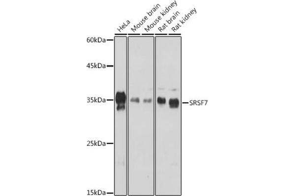 SFRS7 antibody  (AA 60-120)