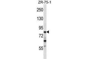 CNOT3 Antibody (N-term) western blot analysis in ZR-75-1 cell line lysates (35µg/lane). (CNOT3 antibody  (N-Term))